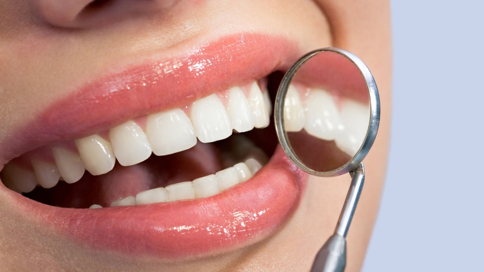 Natural Teeth Whitener (2)